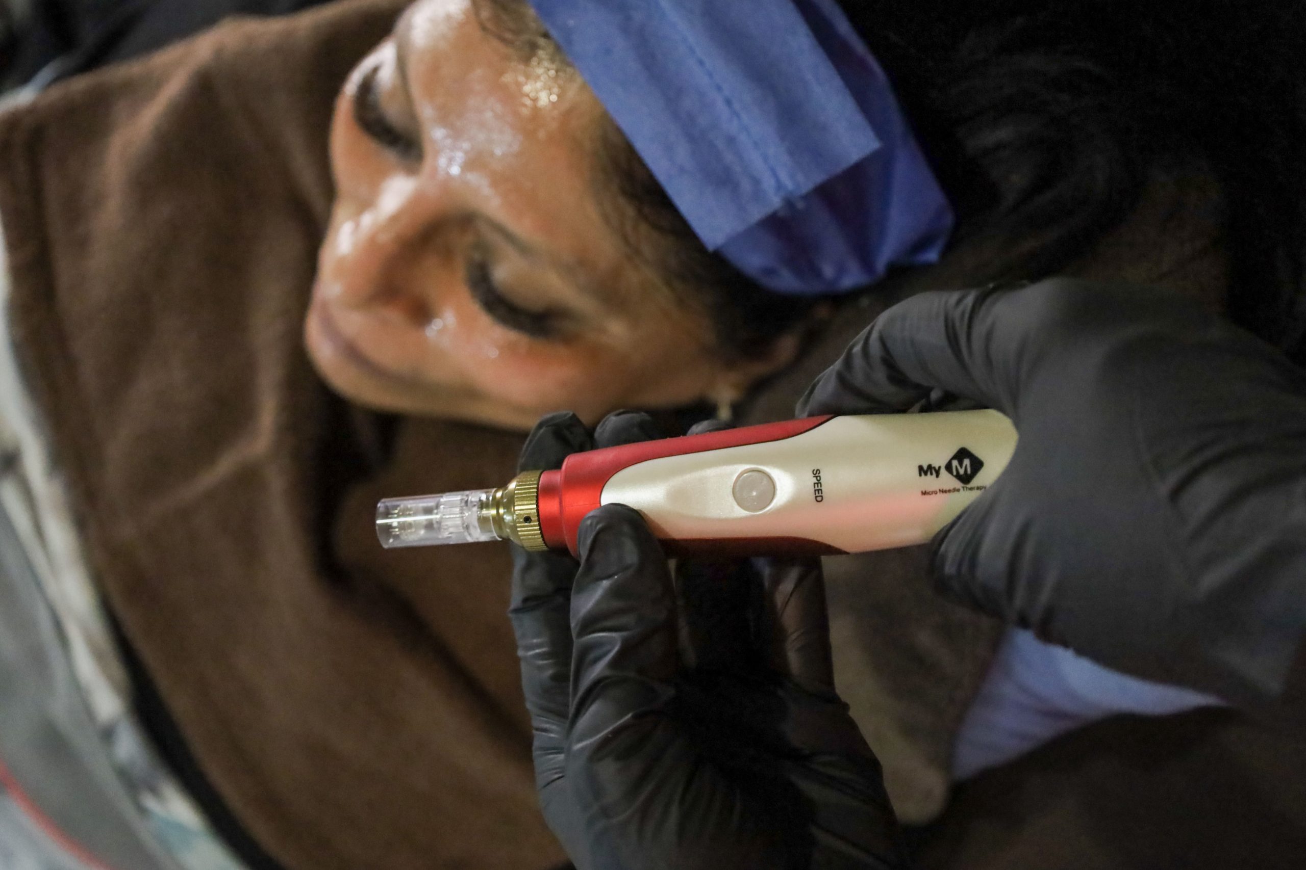 dermapen EN CUERNAVACA